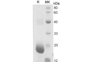 Western Blotting (WB) image for Hydroxyprostaglandin Dehydrogenase 15-(NAD) (HPGD) (Active) protein (His tag) (ABIN7320930) (HPGD Protein (His tag))