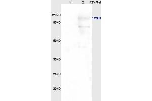 Lane 1: human colon carcinoma lysates Lane 2: rat brain lysates probed with Anti PARP (N-Terminus) Polyclonal Antibody, Unconjugated (ABIN677903) at 1:200 in 4 °C. (PARP1 Antikörper  (AA 201-300))