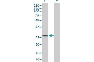 Western Blotting (WB) image for anti-Major Histocompatibility Complex, Class II, DR beta 1 (HLA-DRB1) (AA 1-266) antibody (ABIN516511)