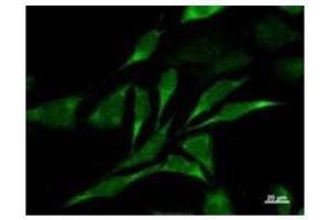 Immunostaining analysis in HeLa cells. (CARD8 Antikörper)