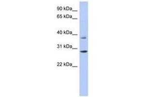 Image no. 1 for anti-Homeobox C5 (HOXC5) (C-Term) antibody (ABIN6742851) (Homeobox C5 Antikörper  (C-Term))