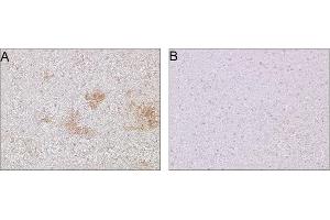 10 µm of coronal sections from fresh-frozen transgenic mouse brain mutant (A) and wild type (B). (beta Amyloid Antikörper)