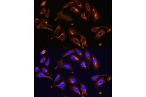 Immunofluorescence analysis of U-2 OS cells using MLPH antibody (ABIN6128273, ABIN6143892, ABIN6143893 and ABIN6222354) at dilution of 1:100. (Melanophilin Antikörper  (AA 301-600))