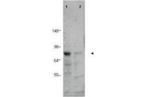 Image no. 1 for anti-CCCTC-Binding Factor (Zinc Finger Protein)-Like (CTCFL) (AA 9-26) antibody (ABIN199968) (CTCFL Antikörper  (AA 9-26))