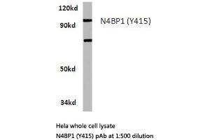 Western blot (WB) analysis of N4BP1 antibody in extracts from Hela cells. (N4BP1 Antikörper)