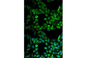 Immunofluorescence analysis of MCF7 cell using IKBKG antibody.