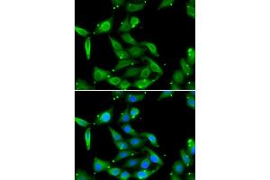 Immunofluorescence analysis of U20S cell using GAMT antibody.