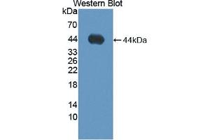 Detection of Recombinant ADAMTS19, Human using Polyclonal Antibody to A Disintegrin And Metalloproteinase With Thrombospondin 19 (ADAMTS19) (ADAMTS19 Antikörper  (AA 325-686))