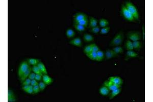 Immunofluorescent analysis of PC-3 cells using ABIN7153293 at dilution of 1:100 and Alexa Fluor 488-congugated AffiniPure Goat Anti-Rabbit IgG(H+L) (GRK4 Antikörper  (AA 1-245))