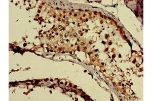 Immunohistochemistry of paraffin-embedded human testis tissue using ABIN7154703 at dilution of 1:100 (GNAQ Antikörper  (AA 1-359))