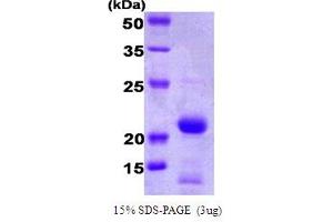 SDS-PAGE (SDS) image for BH3 Interacting Domain Death Agonist (BID) (AA 1-195) protein (ABIN668038)