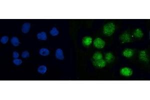 IF analysis of BRCC36/BRCC3 using anti-BRCC36/BRCC3 antibody (ABIN7599595). (BRCC3 Antikörper  (AA 10-276))