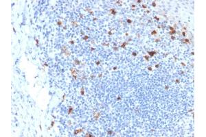 Immunohistochemistry (IHC) image for anti-Integrin, alpha E (Antigen CD103, Human Mucosal Lymphocyte Antigen 1, alpha Polypeptide) (ITGAE) antibody (ABIN6939806)