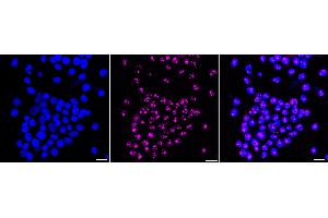 Immunocytochemical staining of HeLa cells with NOLC1 antibody (ABIN7799665), 1:1,000).