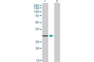 Western Blot analysis of LDB3 expression in transfected 293T cell line by LDB3 monoclonal antibody (M06A), clone 3C8. (LIM Domain Binding 3 Protein Antikörper  (AA 1-283))