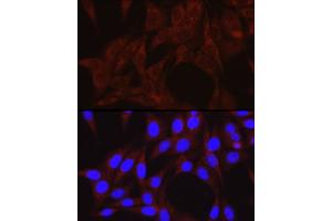 Immunofluorescence analysis of NIH/3T3 cells using PIK3C3/VPS34 Rabbit pAb (ABIN6134410, ABIN6145632, ABIN6145634 and ABIN6216127) at dilution of 1:50 (40x lens). (PIK3C3 Antikörper  (AA 150-250))