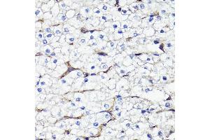 Immunohistochemistry of paraffin-embedded human liver using CD44 antibody (ABIN7266201) at dilution of 1:100 (40x lens). (CD44 Antikörper  (AA 346-385))