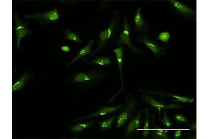 Immunofluorescence of purified MaxPab antibody to PDXDC1 on HeLa cell. (PDXDC1 Antikörper  (AA 1-788))