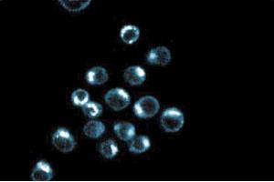 Immunoflourescence staining of HeLa cells. (p230 Trans Golgi (AA 2063-2179) Antikörper)