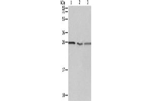 Western Blotting (WB) image for anti-Proteasome (Prosome, Macropain) 26S Subunit, Non-ATPase, 9 (PSMD9) antibody (ABIN2428649) (PSMD9 Antikörper)