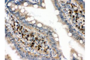 Immunohistochemistry (IHC) image for anti-Eukaryotic Translation Initiation Factor 4A2 (EIF4A2) (AA 5-31), (N-Term) antibody (ABIN3043426)