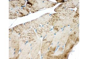 Anti-SERCA1 ATPase antibody, IHC(P) IHC(P): Rat Skeletal Muscle Tissue (ATP2A1/SERCA1 Antikörper  (Middle Region))