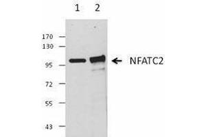 Western Blotting (WB) image for anti-Nuclear Factor of Activated T-Cells, Cytoplasmic, Calcineurin-Dependent 2 (NFAT1) antibody (ABIN2665286) (NFAT1 Antikörper)