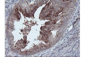 Immunohistochemistry (IHC) image for anti-Retinaldehyde Binding Protein 1 (RLBP1) antibody (ABIN1497622) (RLBP1 Antikörper)