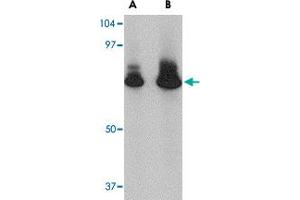 Western blot analysis of ATG16L1 in HeLa cell lysate with ATG16L1 polyclonal antibody  at (A) 1 and (B) 2 ug/mL . (ATG16L1 Antikörper  (N-Term))
