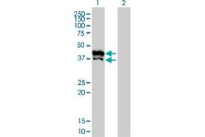 Western Blot analysis of GPD2 expression in transfected 293T cell line by GPD2 monoclonal antibody (M02), clone 2C11-1F4. (GPD2 Antikörper  (AA 1-378))