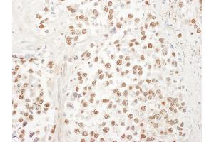 Immunohistochemistry (IHC) image for anti-Ubiquitin-Like 7 (Bone Marrow Stromal Cell-Derived) (UBL7) (AA 330-380) antibody (ABIN7454886) (UBL7 Antikörper  (AA 330-380))