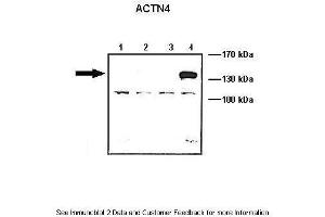 Lanes:   Lane1: 10 ug ACTN1-GFP transfected COS-7 lysate Lane2: 10 ug ACTN2-GFP transfected COS-7 lysate Lane3: 10 ug ACTN3-GFP transfected COS-7 lysate Lane4: 10 ug ACTN4-GFP transfected COS-7 lysate  Primary Antibody Dilution:   1: 1000  Secondary Antibody:   Anti-rabbit HRP  Secondary Antibody Dilution:   1:5000  Gene Name:   ACTN4  Submitted by:   Johannes W. (alpha Actinin 4 Antikörper  (N-Term))