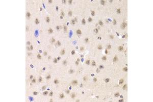 Immunohistochemistry of paraffin-embedded mouse brain using PRPF3 Antibody (ABIN5973192) at dilution of 1/100 (40x lens). (PRPF3 Antikörper)