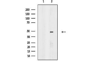 Western blot analysis of lysates from HepG2 cells(H2O2 treatment), using MAZ Antibody.