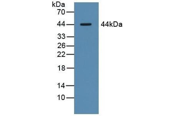 Asialoglycoprotein Receptor 1 Antikörper  (AA 77-289)