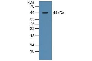 Detection of ASGR1 in Porcine Liver Tissue using Polyclonal Antibody to Asialoglycoprotein Receptor 1 (ASGR1) (Asialoglycoprotein Receptor 1 Antikörper  (AA 77-289))