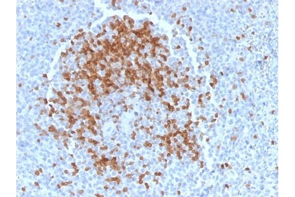 TCL1A antibody  (AA 2-109)