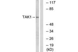 Western blot analysis of extracts from HepG2 cells, using TAK1 (Ab-184) Antibody. (TR4 Antikörper  (AA 161-210))