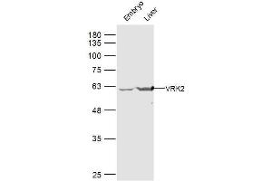 Lane 1: mouse embryo lysates Lane 2: mouse liver lysates probed with VRK2 Polyclonal Antibody, Unconjugated  at 1:300 dilution and 4˚C overnight incubation.