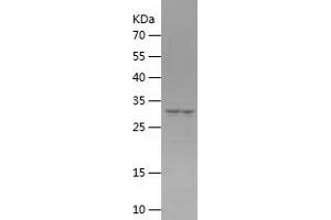 PAK4 Protein (AA 1-259) (His tag)