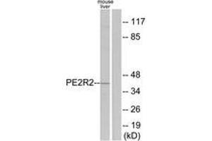 Western blot analysis of extracts from mouse liver cells, using PE2R2 Antibody. (PTGER2 Antikörper  (AA 261-310))