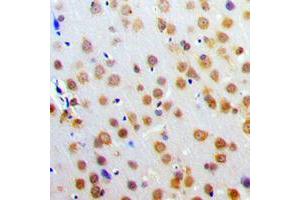 Immunohistochemical analysis of SNAP25 staining in human brain formalin fixed paraffin embedded tissue section. (SNAP25 Antikörper  (C-Term))