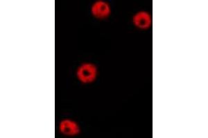 ABIN6275446 staining HepG2 by IF/ICC. (GFR Antikörper  (C-Term))