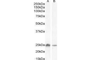 Western Blotting (WB) image for anti-Catechol-O-Methyltransferase (COMT) (N-Term) antibody (ABIN185328)