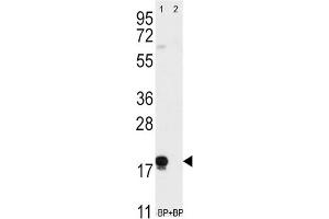Western Blotting (WB) image for anti-CD90 (THY1) antibody (ABIN3001433) (CD90 Antikörper)