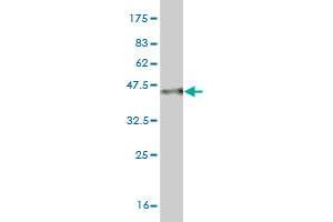 Western Blot detection against Immunogen (35. (MYO3A Antikörper  (AA 1400-1490))