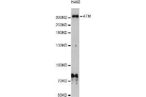 Western blot analysis of extracts of H460 cells, using ATM Antibody (ABIN5973499) at 1/1000 dilution. (ATM Antikörper)