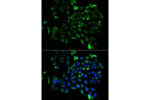 Immunofluorescence analysis of A549 cells using EEF1B2 antibody (ABIN5973953). (EEF1B2 Antikörper)