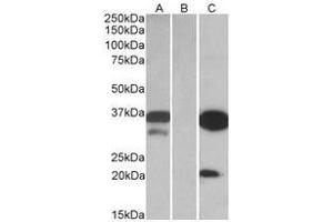 HEK293 lysate (10 µg protein in RIPA buffer) over expressing Human DAPP1 with DYKDDDDK tag probed with this Antibody (0. (DAPP1 Antikörper  (Internal Region))