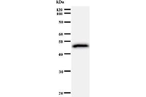 Western Blotting (WB) image for anti-General Transcription Factor II I Repeat Domain-Containing 1 (GTF2IRD1) antibody (ABIN930918)